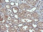 DDX58 Antibody in Immunohistochemistry (Paraffin) (IHC (P))