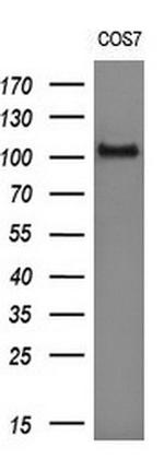 DDX58 Antibody in Western Blot (WB)