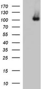 DDX58 Antibody in Western Blot (WB)