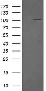 DDX58 Antibody in Western Blot (WB)