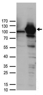 DDX58 Antibody in Western Blot (WB)