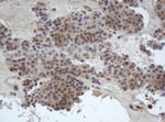 DDX59 Antibody in Immunohistochemistry (Paraffin) (IHC (P))