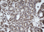 DDX59 Antibody in Immunohistochemistry (Paraffin) (IHC (P))