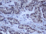 DDX59 Antibody in Immunohistochemistry (Paraffin) (IHC (P))