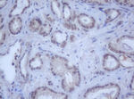 DDX59 Antibody in Immunohistochemistry (Paraffin) (IHC (P))