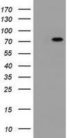 DDX59 Antibody in Western Blot (WB)