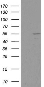 DDX6 Antibody in Western Blot (WB)