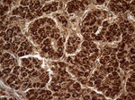 DECR1 Antibody in Immunohistochemistry (Paraffin) (IHC (P))