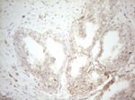 DECR1 Antibody in Immunohistochemistry (Paraffin) (IHC (P))