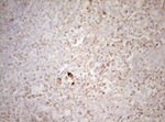 DECR1 Antibody in Immunohistochemistry (Paraffin) (IHC (P))