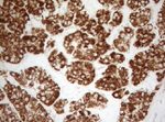 DECR1 Antibody in Immunohistochemistry (Paraffin) (IHC (P))