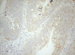 DECR1 Antibody in Immunohistochemistry (Paraffin) (IHC (P))