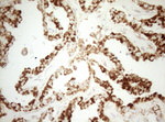 DECR1 Antibody in Immunohistochemistry (Paraffin) (IHC (P))