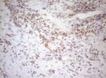 DECR1 Antibody in Immunohistochemistry (Paraffin) (IHC (P))