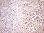 DECR1 Antibody in Immunohistochemistry (Paraffin) (IHC (P))