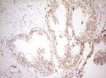 DECR1 Antibody in Immunohistochemistry (Paraffin) (IHC (P))