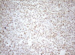 DECR1 Antibody in Immunohistochemistry (Paraffin) (IHC (P))