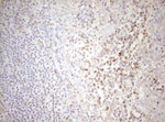 DECR1 Antibody in Immunohistochemistry (Paraffin) (IHC (P))