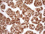 DECR1 Antibody in Immunohistochemistry (Paraffin) (IHC (P))