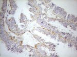 DECR1 Antibody in Immunohistochemistry (Paraffin) (IHC (P))