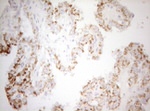 DECR1 Antibody in Immunohistochemistry (Paraffin) (IHC (P))