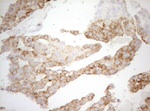 DECR1 Antibody in Immunohistochemistry (Paraffin) (IHC (P))