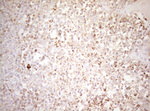 DECR1 Antibody in Immunohistochemistry (Paraffin) (IHC (P))