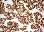 DECR1 Antibody in Immunohistochemistry (Paraffin) (IHC (P))