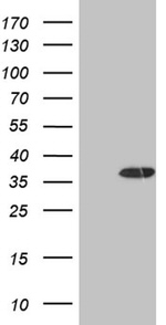 DECR1 Antibody in Western Blot (WB)