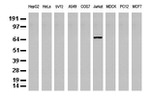 DEF6 Antibody in Western Blot (WB)