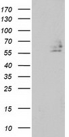 DEF8 Antibody in Western Blot (WB)