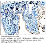 DEK Antibody in Immunohistochemistry (IHC)