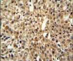 DENND1A Antibody in Immunohistochemistry (IHC)