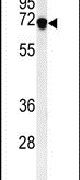 DENND1A Antibody in Western Blot (WB)