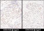 DENTT Antibody in Immunohistochemistry (IHC)