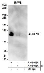 DENTT Antibody in Western Blot (WB)