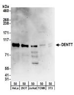 DENTT Antibody in Western Blot (WB)