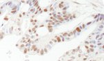 DFF45/DFFA Antibody in Immunohistochemistry (IHC)