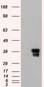 DFF45 Antibody in Western Blot (WB)