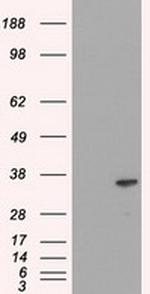 DFF45 Antibody in Western Blot (WB)