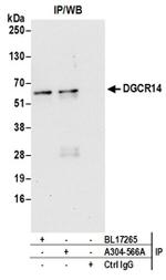 DGCR14 Antibody in Western Blot (WB)