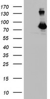 DGKA Antibody in Western Blot (WB)