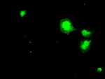 DHFR Antibody in Immunocytochemistry (ICC/IF)