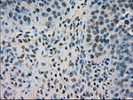 DHFR Antibody in Immunohistochemistry (Paraffin) (IHC (P))