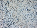 DHFR Antibody in Immunohistochemistry (Paraffin) (IHC (P))