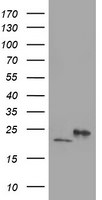 DHFRL1 Antibody in Western Blot (WB)