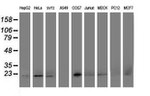 DHFRL1 Antibody in Western Blot (WB)