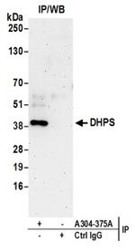 DHPS Antibody in Western Blot (WB)