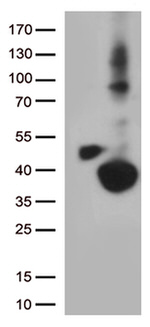 DHRS1 Antibody in Western Blot (WB)