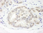 DHX15 Antibody in Immunohistochemistry (IHC)